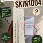 Axis-Y vs Skin1004: Which Serum Actually Fades Dark Spots for Deep Oily Acne-Prone Skin?